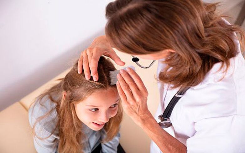 Behandlung der Kopfpsoriasis bei Kindern