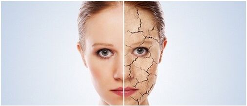 Wir behandeln Psoriasis
