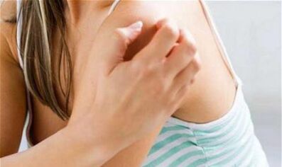 Mädchen kratzt sich an der Schulter